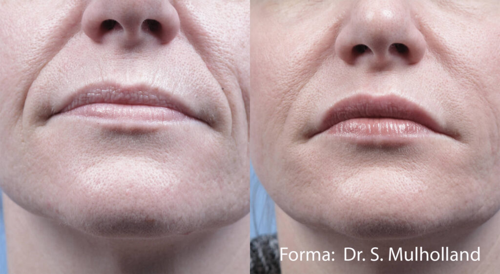 Forma4_blog